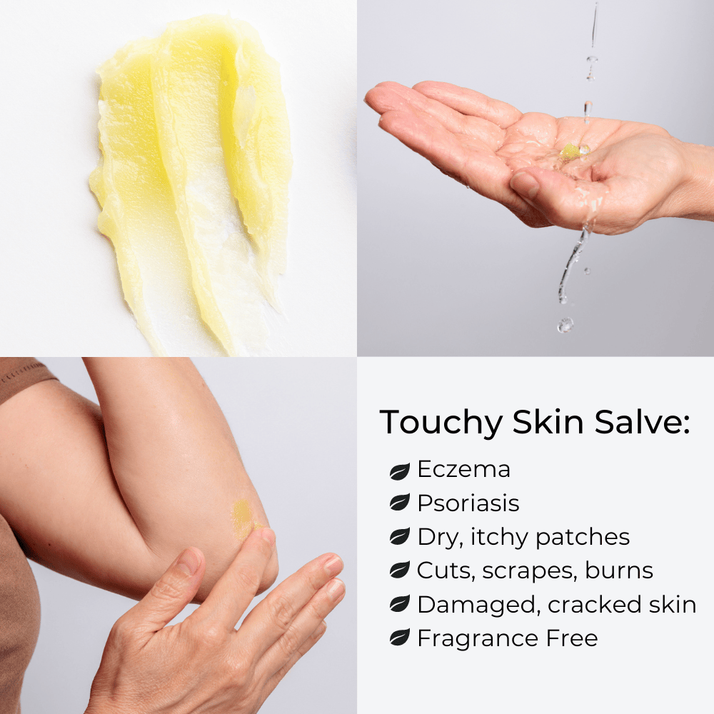 Touchy Skin Salve, Sensitive Skin & Eczema Salve
